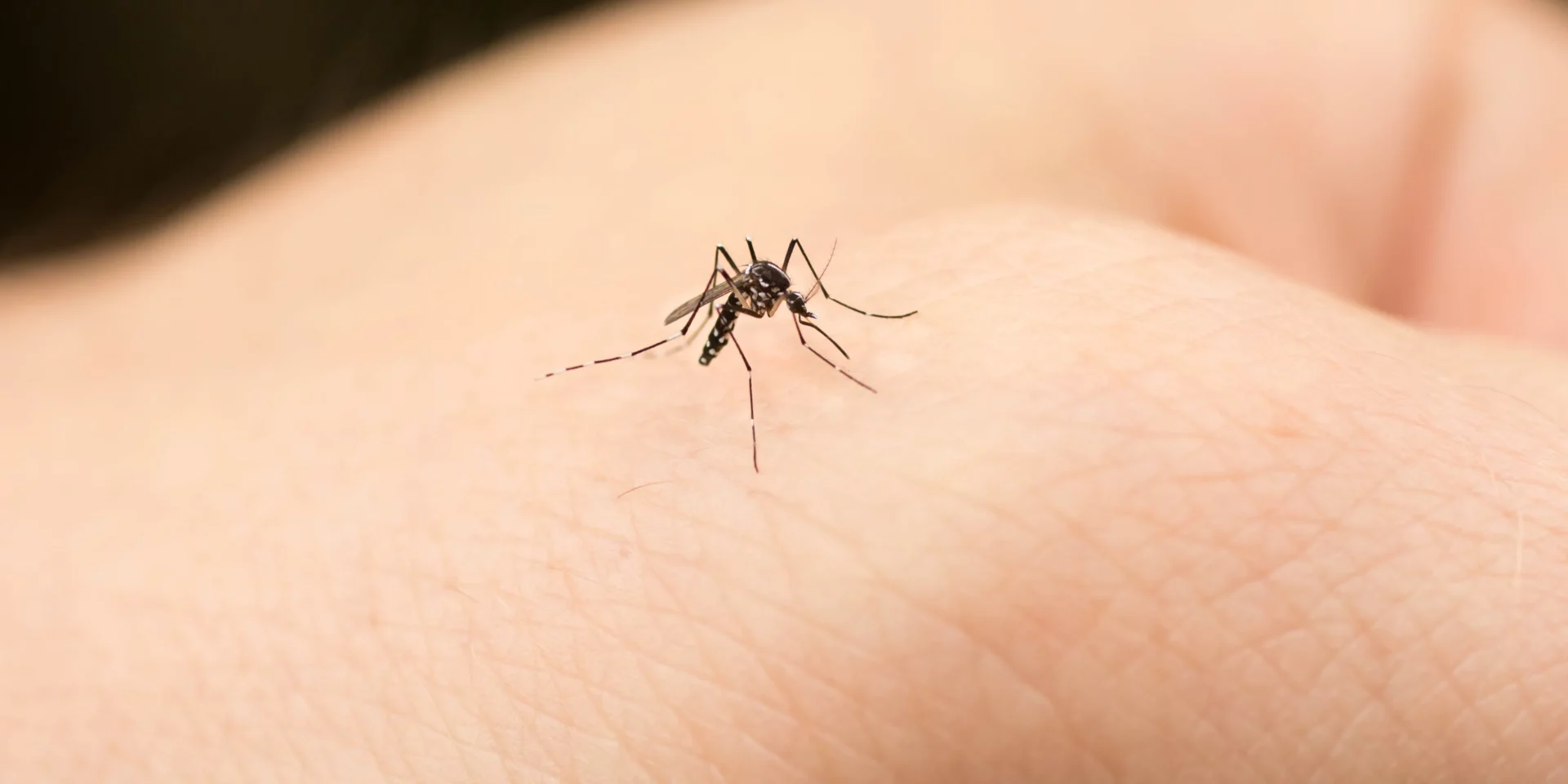 mosquito bite allergy