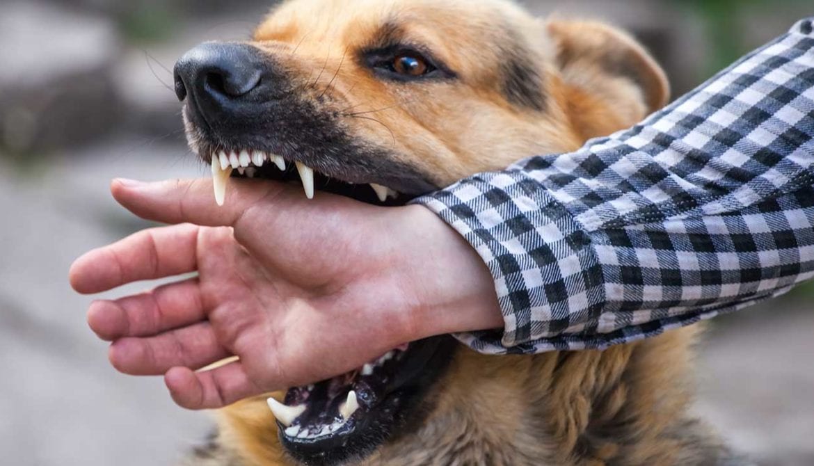 dog bite injury attorneys 1170x670 1
