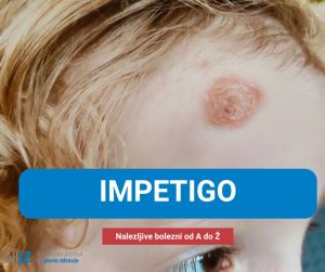 impetigo nijz