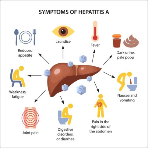 hepatitis