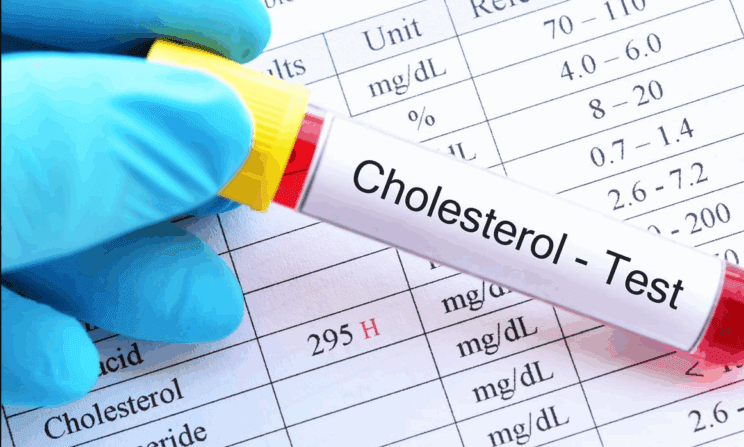 6 mitov o holesterolu, ki ne držijo 2 holesterol