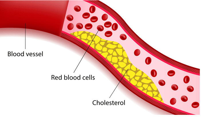 6 mitov o holesterolu, ki ne držijo 4 holesterol