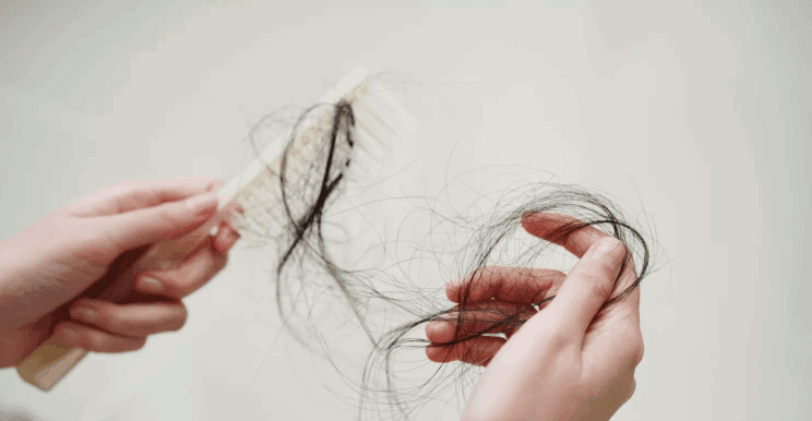 Polovica žensk do 50. leta starosti ima neko obliko izpadanja las! 3 las