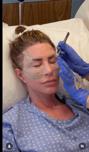 Preden se odločite za lifting obraza, poglejte posnetek 2 lifting