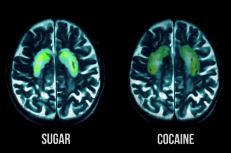 Ta hrana lahko pri otrocih povzroča anksioznost in agresijo! 3 predelana hrana