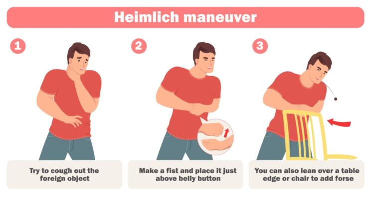 Kako izvajati Heimlichov prijem, ki lahko v nekaj sekundah reši življenje 3 Heimlichov prijem