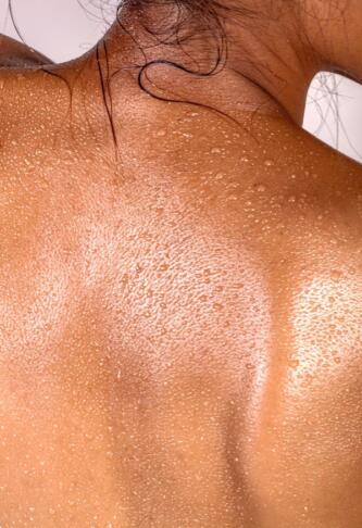 Impetigo na Jadranu: Zdravniki pojasnjujejo, zakaj morje ni vzrok okužbe 2 photo 1654781350550 0dc72ecb6fae